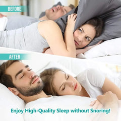 Anti-Snoring Device